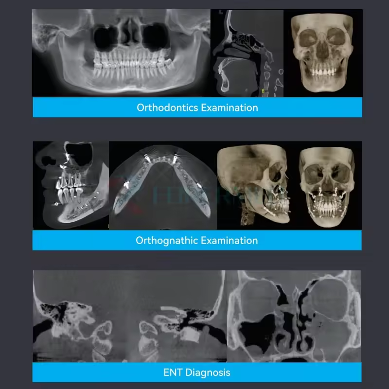 D0101 Hepsi bir arada 3D-serie professionele CBCT röntgen panorama van sefalometrik FOV 23X18cm Ceph Pan CBCT