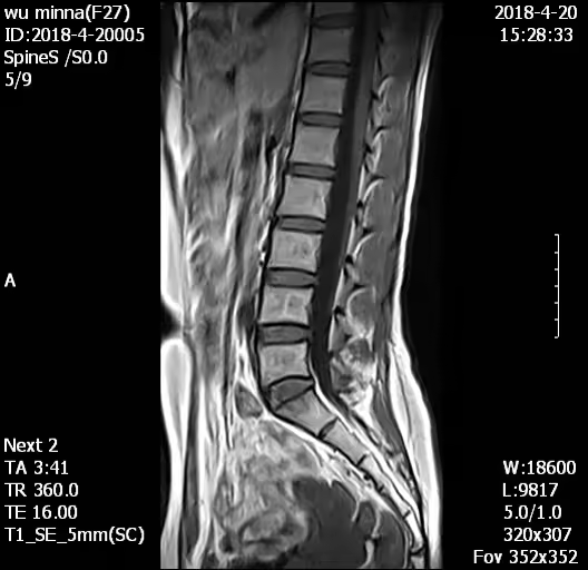 H0038 MY-D054 Hastane Tıbbi 0.5T MRI tarayıcı/tarama/makine ekipman