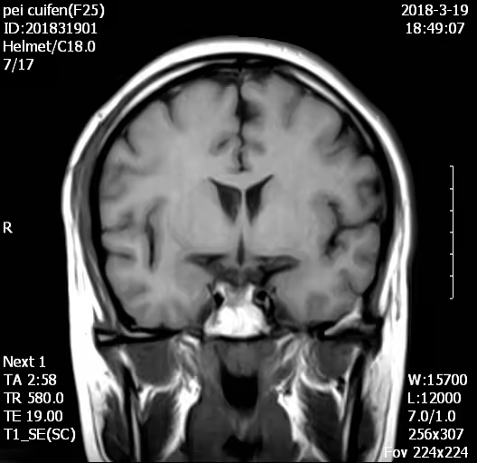 H0038 MY-D054 Hastane Tıbbi 0.5T MRI tarayıcı/tarama/makine ekipman